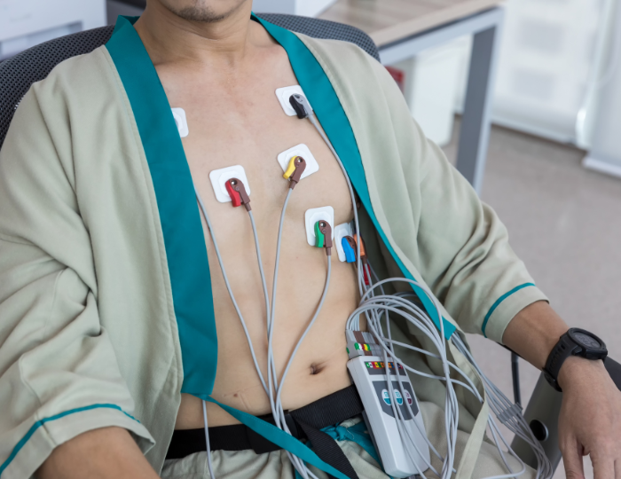 electrocardiogram