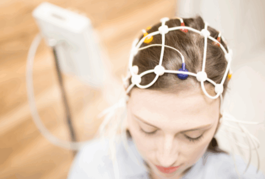 electroencephalogram