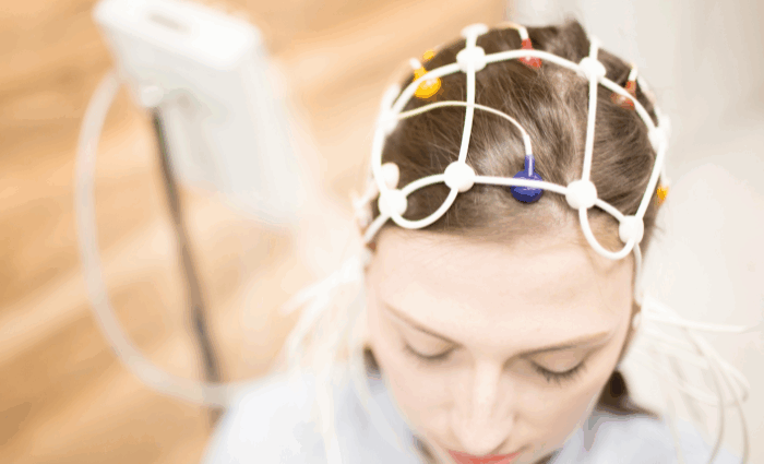 electroencephalogram