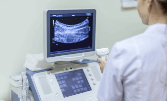 ultrasonography