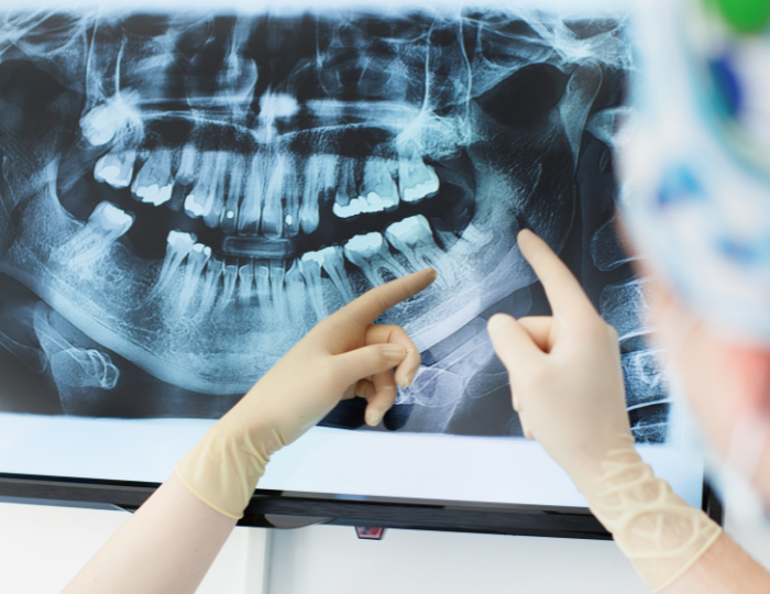x-ray